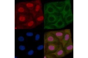 XRRA1 Mouse Monoclonal Antibody staining Hela cells by IF/ICC. (XRRA1 Antikörper)