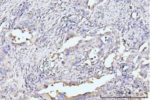 IHC analysis of RPL29 using anti-RPL29 antibody (ABIN7600993). (RPL29 Antikörper  (AA 27-153))
