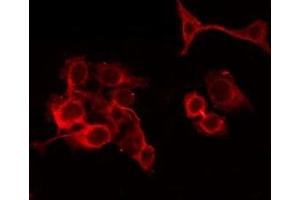 ABIN6279648 staining Hela by IF/ICC. (PAOX Antikörper  (Internal Region))