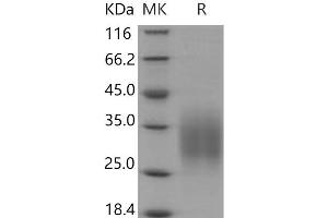 Western Blotting (WB) image for CD83 (CD83) (AA 1-133) protein (His tag) (ABIN7320187) (CD83 Protein (CD83) (AA 1-133) (His tag))