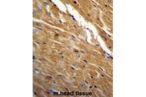 Immunohistochemistry (Paraffin-embedded Sections) (IHC (p)) image for anti-TBC1 Domain Family, Member 13 (TBC1D13) (AA 83-113), (Middle Region) antibody (ABIN955091)