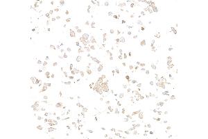 Immunocytochemistry (ICC) image for anti-Met Proto-Oncogene (MET) (C-Term) antibody (ABIN7795683) (Rekombinanter c-MET Antikörper  (C-Term))