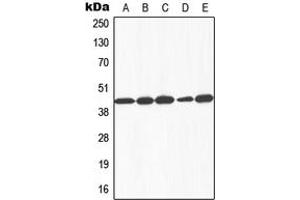 Western blot analysis of Galactose Kinase expression in HEK293T (A), HepG2 (B), SP2/0 (C), rat liver (D), Human liver (E) whole cell lysates. (GALK1 Antikörper  (N-Term))