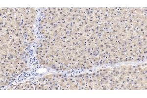 Immunohistochemistry (IHC) image for anti-Insulin-Like Growth Factor Binding Protein 2, 36kDa (IGFBP2) (AA 30-316) antibody (ABIN7430597)