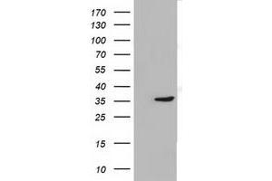 Western Blotting (WB) image for anti-Short Chain Dehydrogenase/reductase Family 9C, Member 7 (SDR9C7) antibody (ABIN1500846) (SDR9C7 Antikörper)