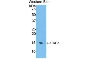 Detection of Recombinant UCP1, Rat using Polyclonal Antibody to Uncoupling Protein 1, Mitochondrial (UCP1) (UCP1 Antikörper  (AA 179-296))