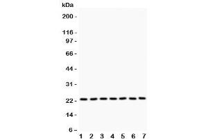 Western blot testing of GSTP1 antibody and Lane 1:  rat brain (GSTP1 Antikörper  (AA 2-210))