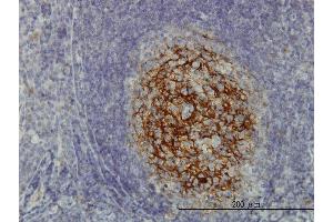 Immunoperoxidase of monoclonal antibody to SDCBP on formalin-fixed paraffin-embedded human tonsil. (SDCBP Antikörper  (AA 1-100))