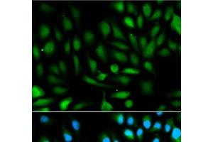 Immunofluorescence analysis of HeLa cells using PARK7 Polyclonal Antibody (PARK7/DJ1 Antikörper)