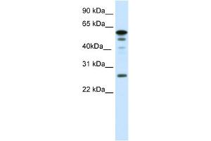 WB Suggested Anti-FOXD1 Antibody Titration:  0.