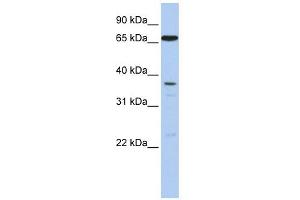 ABCB9 antibody used at 1 ug/ml to detect target protein. (ABCB9 Antikörper)