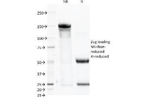 SDS-PAGE Analysis Purified CD46 Mouse Monoclonal Antibody (122. (CD46 Antikörper)