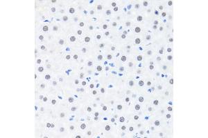 Immunohistochemistry of paraffin-embedded rat liver using BRMS1 antibody (ABIN7265929) at dilution of 1:100 (40x lens). (BRMS1 Antikörper  (AA 90-210))