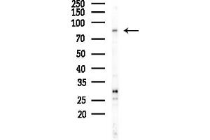 Western blot analysis of lysates from LoVo cells(heat-shock,45 min treatment), using ALS2CR8 Antibody at 1/1000 dilution.