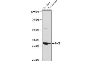 Western blot analysis of extracts of various cell lines, using (ABIN6132916, ABIN6148756, ABIN6148757 and ABIN6223050) at 1:1000 dilution. (SYCE1 Antikörper  (AA 132-351))