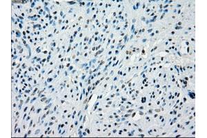 Immunohistochemical staining of paraffin-embedded colon tissue using anti-KDM4C mouse monoclonal antibody. (KDM4C Antikörper)