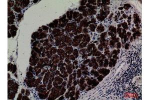 Immunohistochemistry (IHC) analysis of paraffin-embedded Human Pancreas, antibody was diluted at 1:100. (CD1e Antikörper  (C-Term))