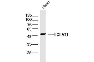 LCLAT1 Antikörper  (AA 261-360)
