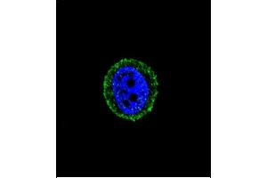 Confocal immunofluorescent analysis of CALCR Antibody (C-term) (ABIN651875 and ABIN2840433) with MCF-7 cell followed by Alexa Fluor® 488-conjugated goat anti-rabbit lgG (green). (Calcitonin Receptor Antikörper  (AA 465-494))