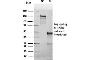 Western Blotting (WB) image for anti-Cystic Fibrosis Transmembrane Conductance Regulator (ATP-Binding Cassette Sub-Family C, Member 7) (CFTR) (AA 258-385) antibody (ABIN7504154)