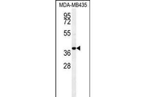 CCR8 Antibody (C-term) (ABIN654442 and ABIN2844176) western blot analysis in MDA-M cell line lysates (35 μg/lane). (CCR8 Antikörper  (AA 305-335))