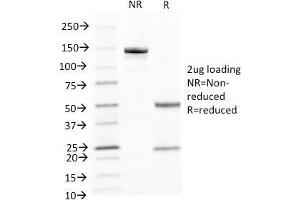 SDS-PAGE Analysis Purified Cytokeratin 10 Monoclonal Antibody (KRT10/844). (Keratin 10 Antikörper)