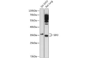 Western blot analysis of extracts of various cell lines, using SIX3 antibody (ABIN7270319) at 1:1000 dilution. (SIX3 Antikörper)