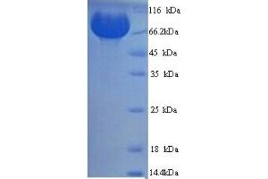 SDS-PAGE (SDS) image for Membrane Metallo-Endopeptidase (MME) (AA 52-750) protein (His tag) (ABIN5713648)