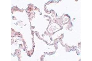 Immunohistochemistry (IHC) image for anti-Pleckstrin Homology Domain Containing, Family M (With RUN Domain) Member 1 (PLEKHM1) (N-Term) antibody (ABIN1031519) (PLEKHM1 Antikörper  (N-Term))