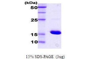 Figure annotation denotes ug of protein loaded and % gel used. (DnaK (AA 385-546) Peptid)
