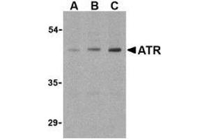 Western blot analysis of ATR in HepG2 cell lysates with this product atR antibody (IN) at (A) 0.