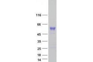 Western Blotting (WB) image for Angiotensinogen (serpin Peptidase Inhibitor, Clade A, Member 8) (AGT) protein (Myc-DYKDDDDK Tag) (ABIN2714691)