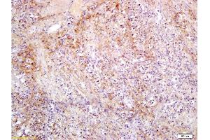Formalin-fixed and paraffin embedded rat colon carcinoma labeled with Anti-Slc22A17 Y Polyclonal Antibody, Unconjugated  at 1:300, followed by conjugation to the secondary antibody and DAB staining (SLC22A17 Antikörper  (AA 475-538))