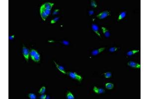 Immunofluorescent analysis of Hela cells using ABIN7166807 at dilution of 1:100 and Alexa Fluor 488-congugated AffiniPure Goat Anti-Rabbit IgG(H+L) (DNAJC6 Antikörper  (AA 201-500))