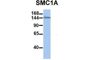 Host:  Rabbit  Target Name:  SMC1A  Sample Type:  Human Jurkat  Antibody Dilution:  1. (SMC1A Antikörper  (C-Term))