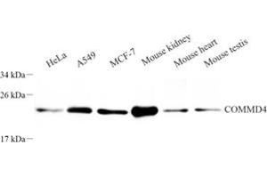 Western blot analysis of COMMD4 (ABIN7073559) at dilution of 1: 250 (COMMD4 Antikörper)