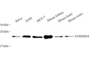 Western blot analysis of COMMD4 (ABIN7073559) at dilution of 1: 250