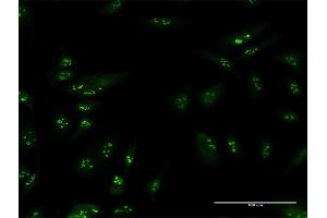 Immunofluorescence of purified MaxPab antibody to TSPYL6 on HeLa cell. (TSPY-Like 6 Antikörper  (AA 1-410))