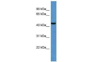 Western Blot showing Dtx3 antibody used at a concentration of 1-2 ug/ml to detect its target protein.