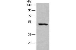 Western blot analysis of Human placenta tissue lysate using KLHDC2 Polyclonal Antibody at dilution of 1:400 (KLHDC2 Antikörper)