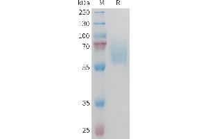 SDS-PAGE (SDS) image for AXL Receptor tyrosine Kinase (AXL) (AA 19-443) protein (His tag) (ABIN7538141)