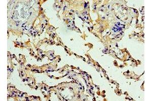 Immunohistochemistry of paraffin-embedded human lung tissue using ABIN7146811 at dilution of 1:100 (CEACAM8 Antikörper  (AA 35-320))
