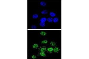 Confocal immunofluorescent analysis of MEF2A antibody with HeLa cells followed by Alexa Fluor 488-conjugated goat anti-rabbit lgG (green). (MEF2A Antikörper  (AA 453-479))