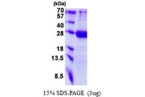 Image no. 1 for Mediator Complex Subunit 20 (MED20) (AA 1-212) protein (His tag) (ABIN1098486)