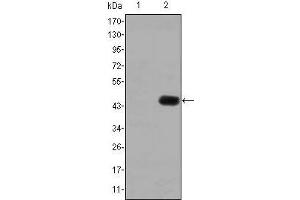 Western blot analysis using CEA mAb against HEK293 (1) and CEA(AA: 460-600)-hIgGFc transfected HEK293 (2) cell lysate. (CEA Antikörper)