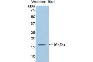 Western Blotting (WB) image for anti-Retinol Binding Protein 3, Interstitial (RBP3) (AA 1027-1229) antibody (ABIN1860413)