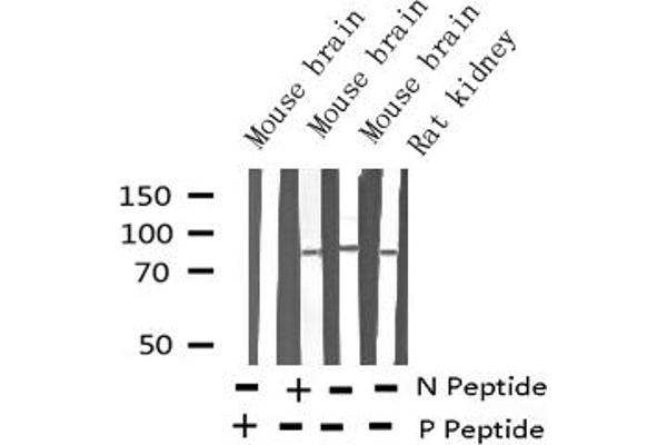 MAPT antibody  (pSer262)