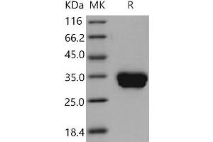 Western Blotting (WB) image for Carbonic Anhydrase IV (CA4) (Active) protein (His tag) (ABIN7194567) (CA4 Protein (His tag))