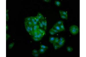 Immunofluorescence staining of HepG2 cells with ABIN7157616 at 1:133, counter-stained with DAPI. (KIF2B Antikörper  (AA 1607-1731))