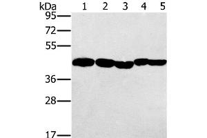 Western Blot analysis of Hela, skov3 and A549 cell, Mouse liver and Human ovarian cancer tissue using PON1 Polyclonal Antibody at dilution of 1:500 (PON1 Antikörper)